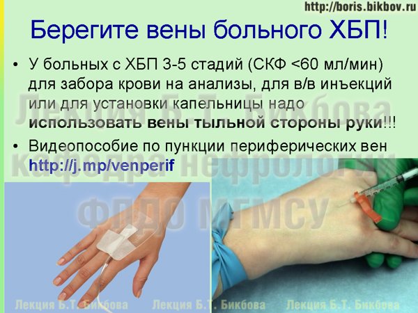Общий анализ крови: палец или вена?